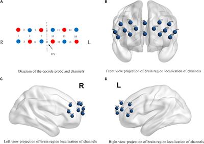 Anger Experience and Anger Expression Through Drawing in Schizophrenia: An fNIRS Study